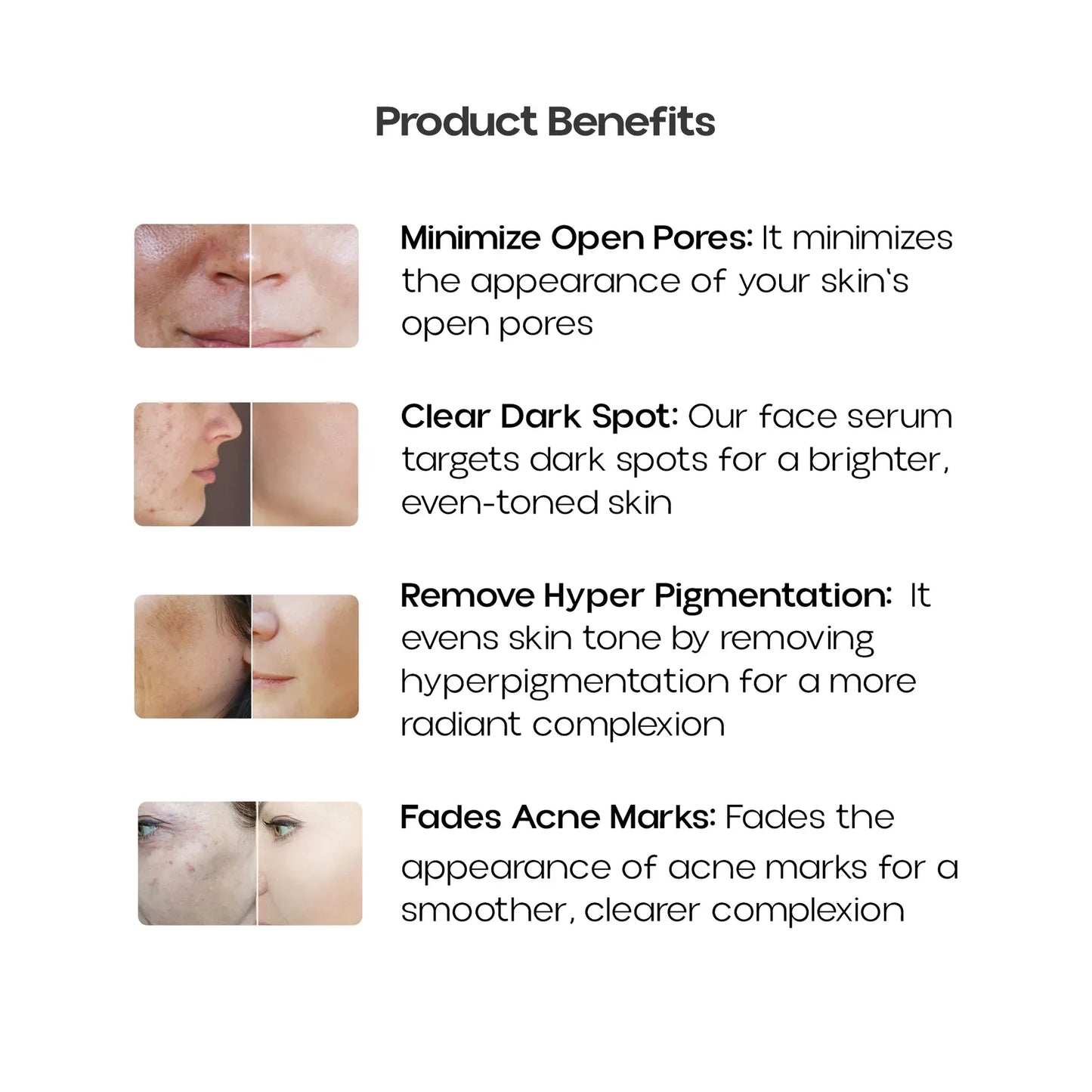 10% NIACINAMIDE FACE SERUM