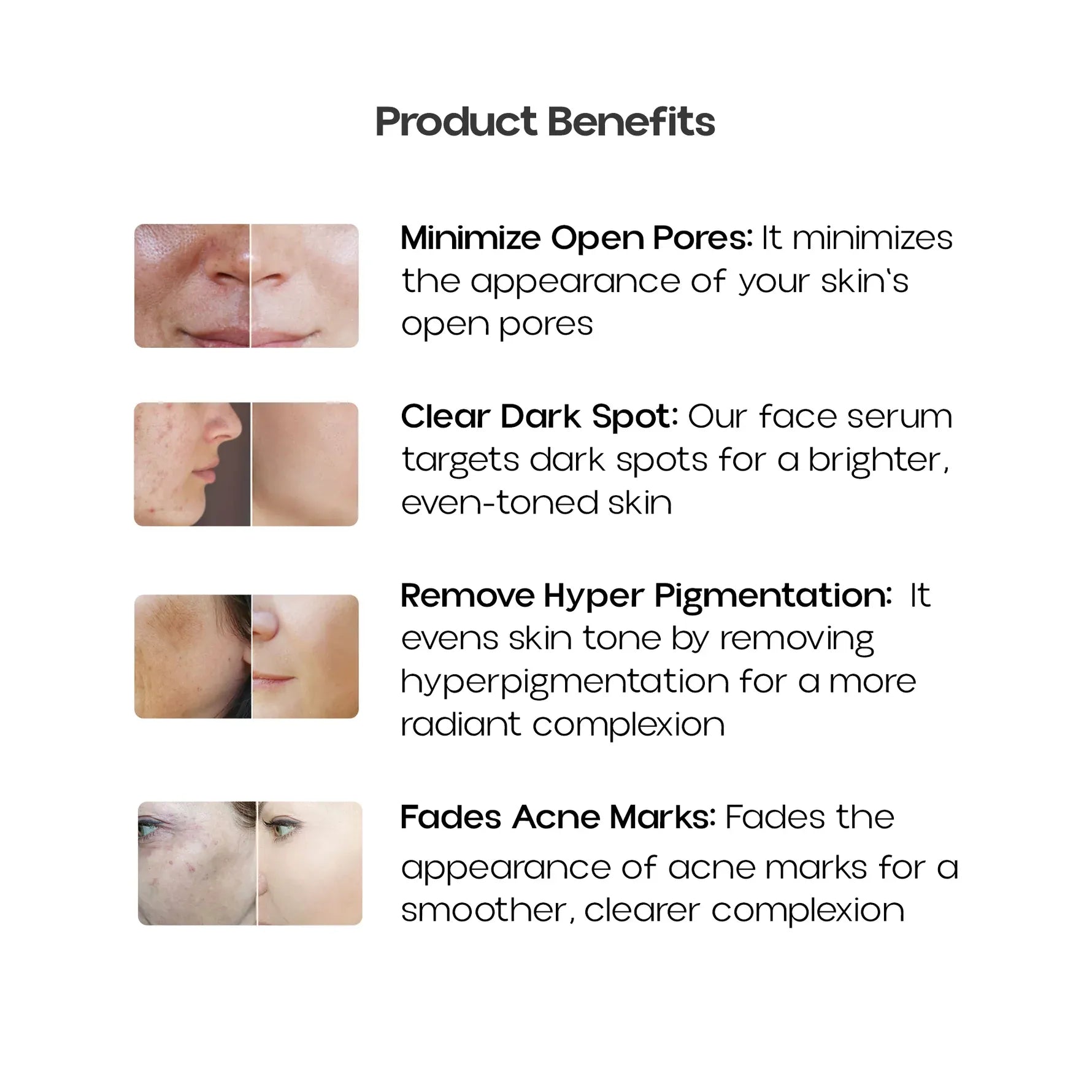 10% NIACINAMIDE FACE SERUM